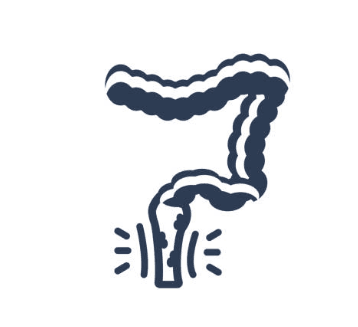 Piles/Hemorrhoids, Fistula & Fissure