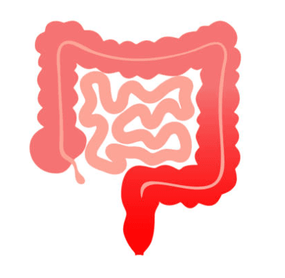 Inflammatory Bowel Disease (IBD)