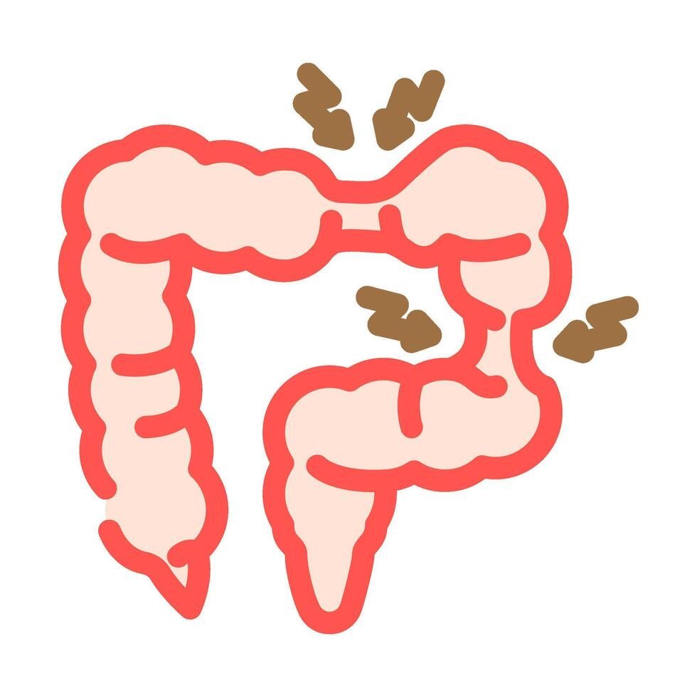 Irritable Bowel Syndrome (IBS)