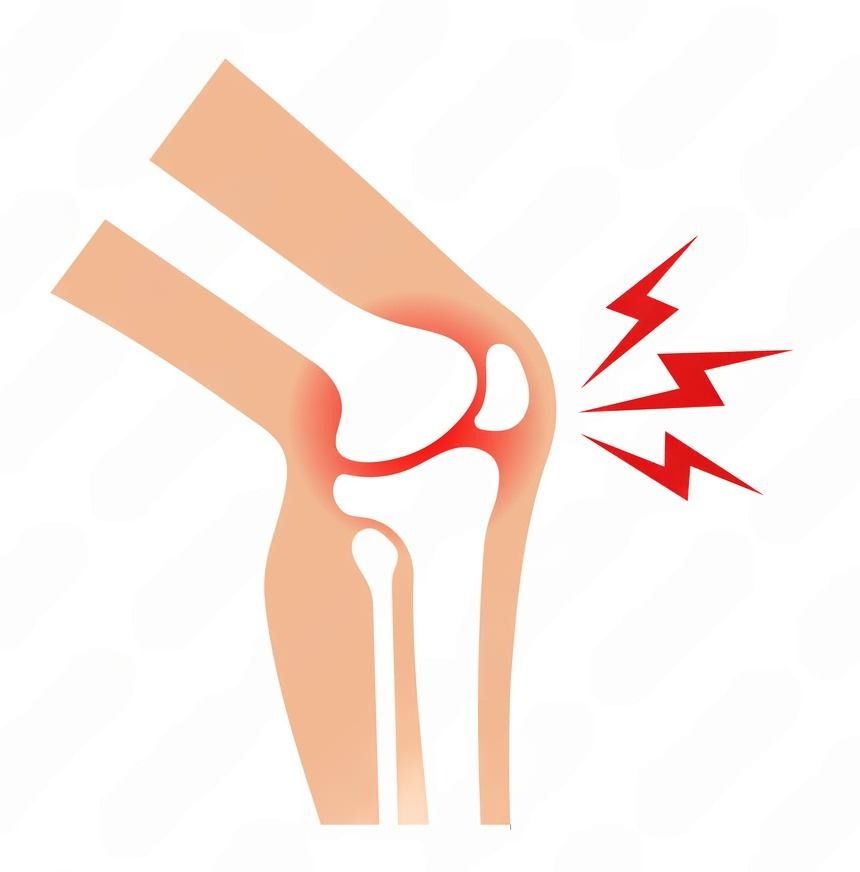 Joint Injuries