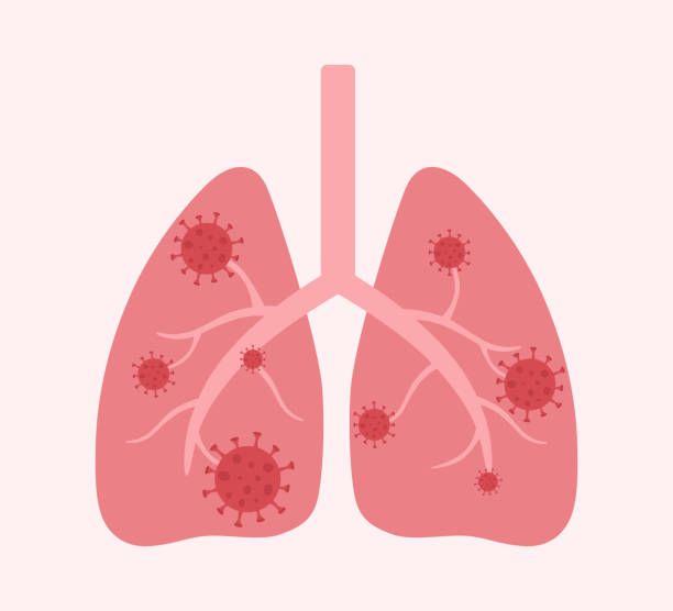 Respiratory Infections