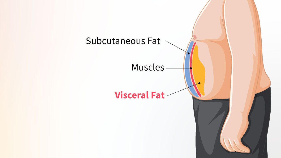 Stubborn Fat Deposits