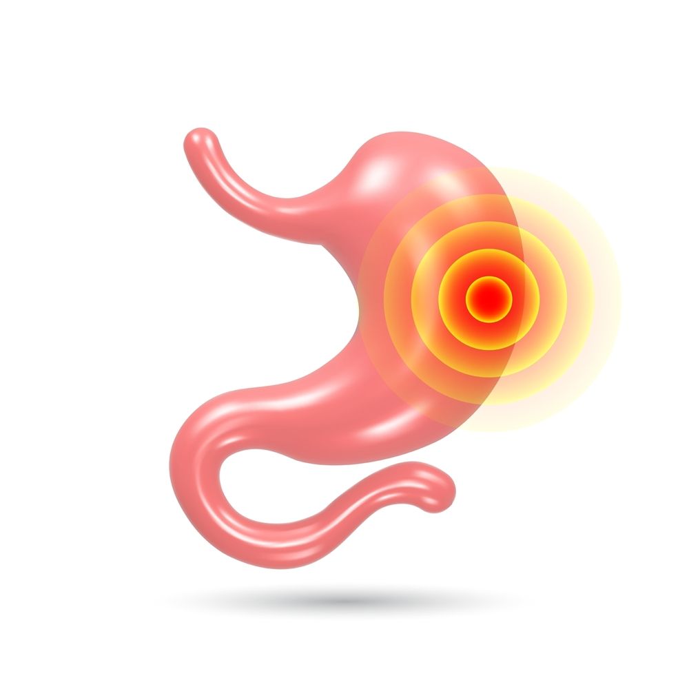 Acid Reflux & Acidity Problems