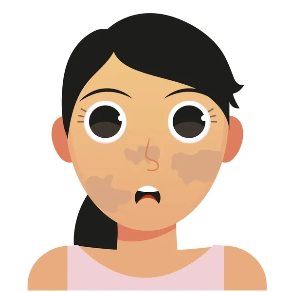 Burn Scars