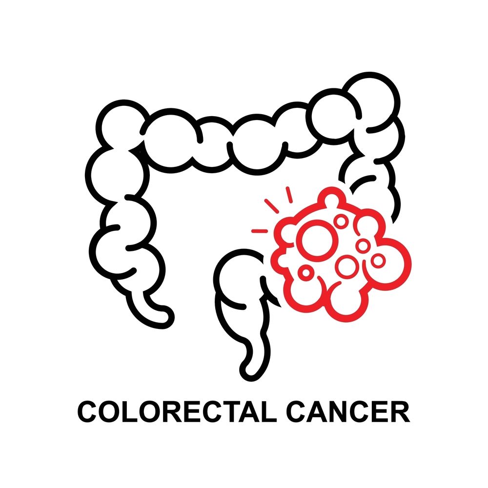 Colorectal Cancer