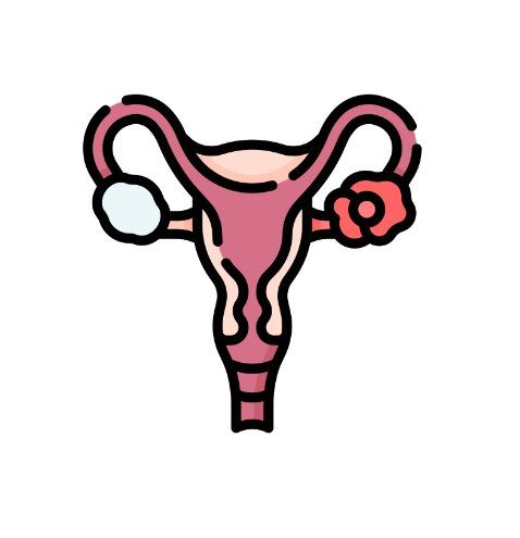 Ovarian Cancer