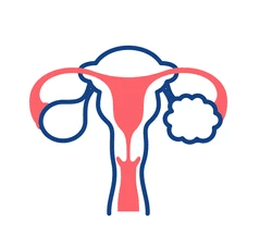 Polycystic Ovary Syndrome (PCOS)