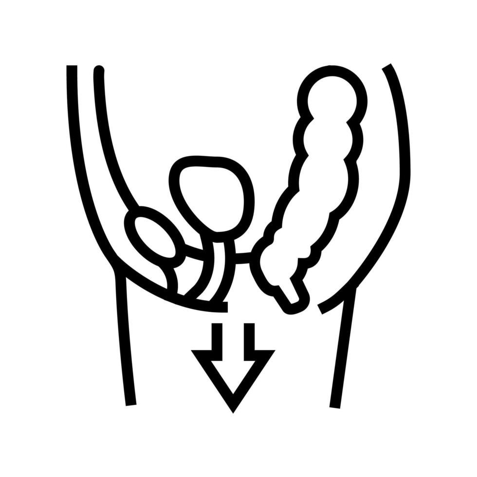 Pelvic Organ Prolapse