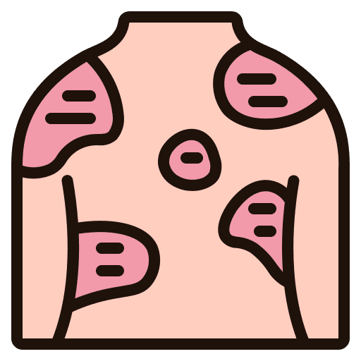 Psoriasis