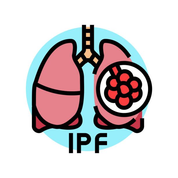 Pulmonary Fibrosis
